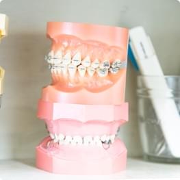 矯正歯科 Orthodontic